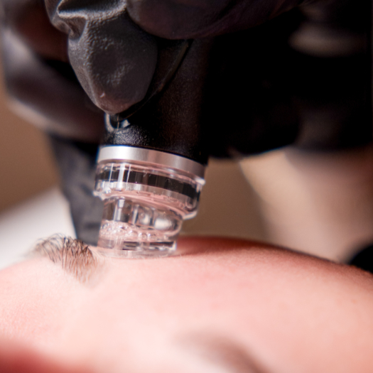 Hydrafacial