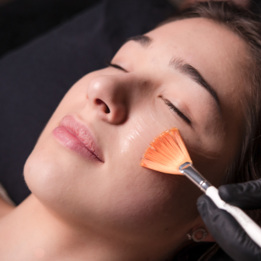 Red Carpet Peel